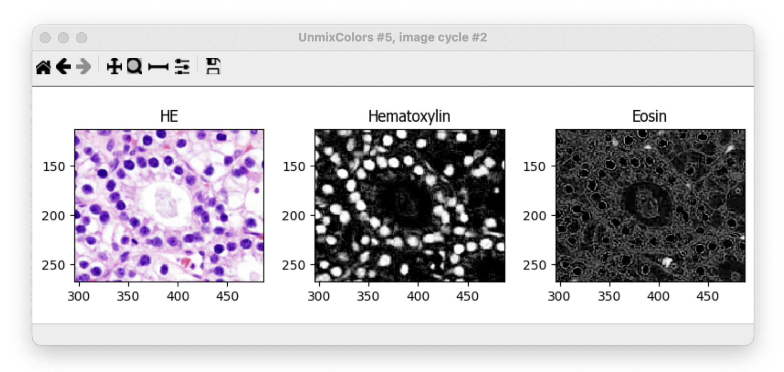 Figure 2. UnmixColors module separes the hematoxylin stain from the eosin stain.