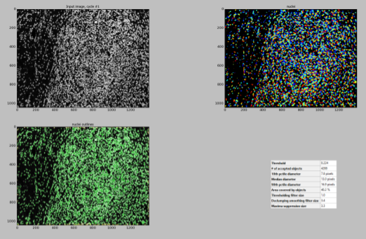 DAPI image enhanced with a filter EnhanceOrSuppressFeatures module.